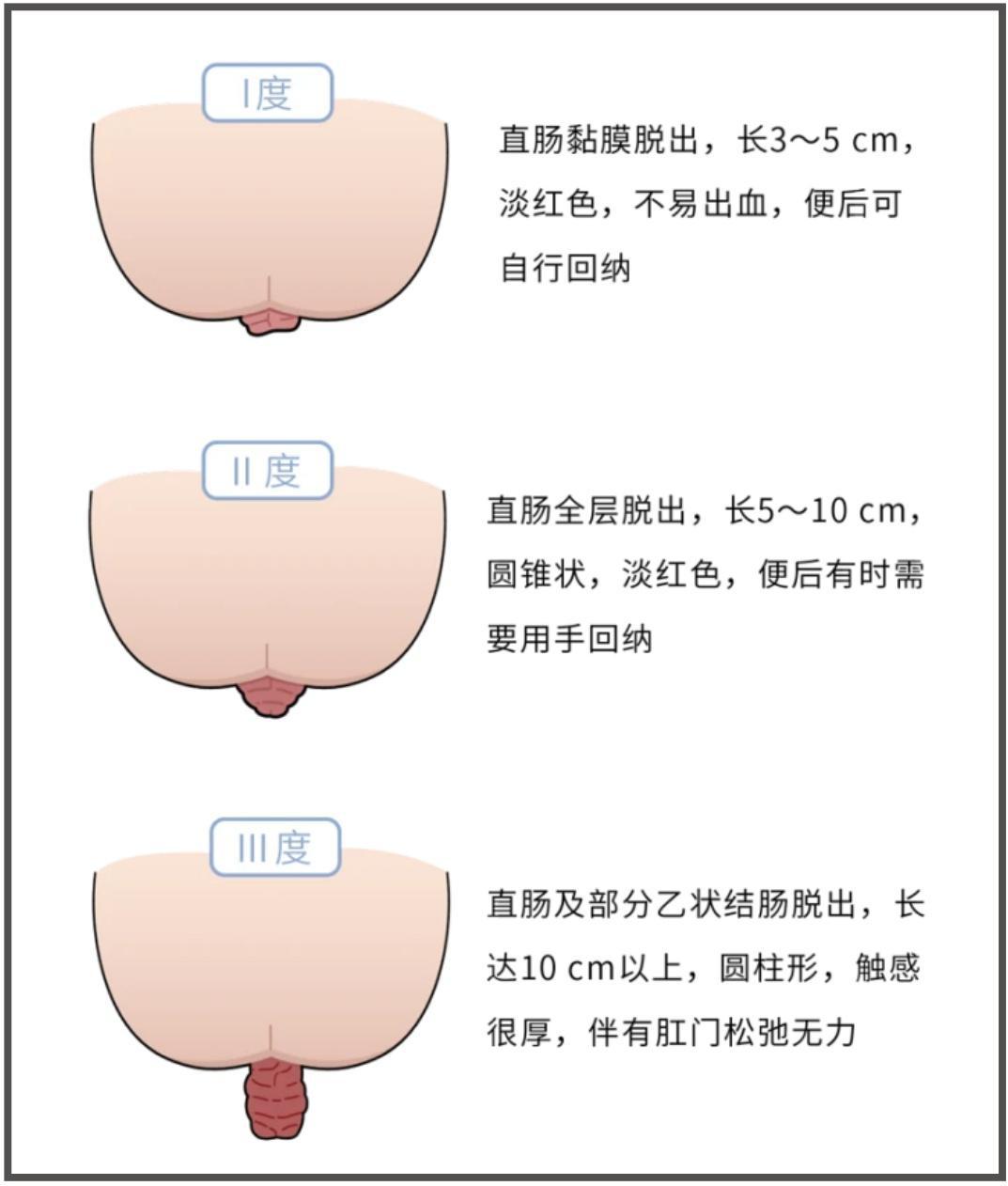 1418154d-0ab4-4d16-828c-872b78958ae4.jpg