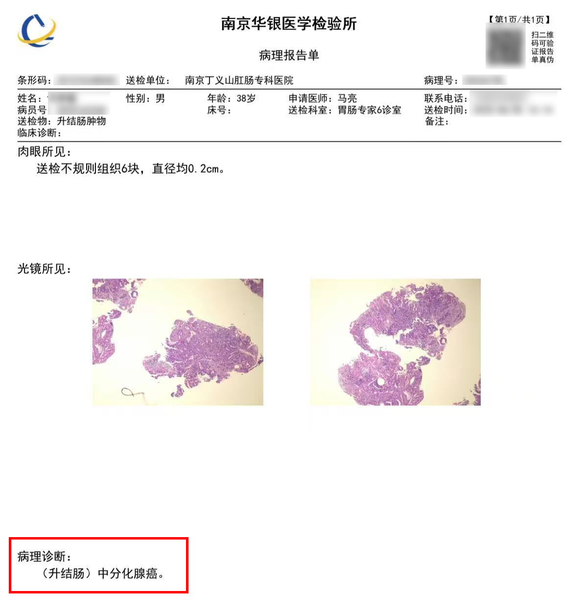 病理结果.jpg